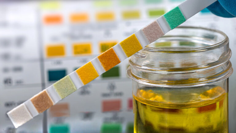 Urine Test Strips for UTIs | Detect Urinary Infections at Home UK