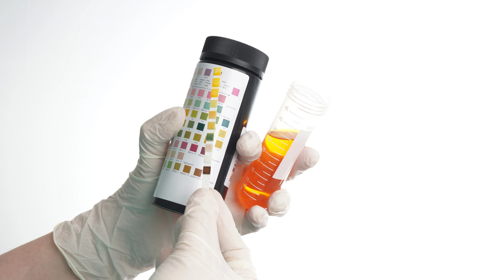Are UTI Test Strips Accurate?